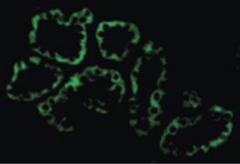 ACE2/ACE-2 Antibody