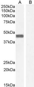 PLEK/Pleckstrin Antibody