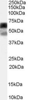 P4HA1 Antibody