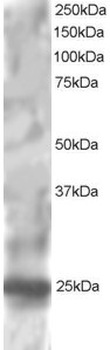 RGS1 Antibody