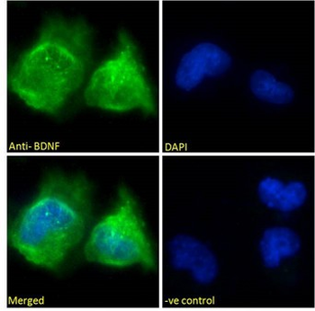 BDNF Antibody