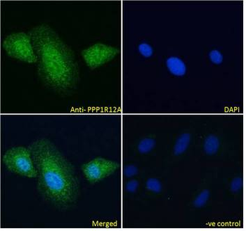 PPP1R12A/MYPT1 Antibody