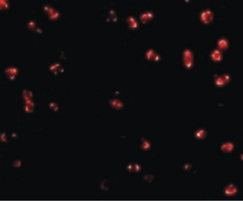 ITGA4/VLA-4/CD49d Antibody