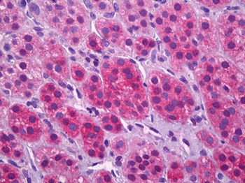 SLC17A7/VGLUT1 Antibody