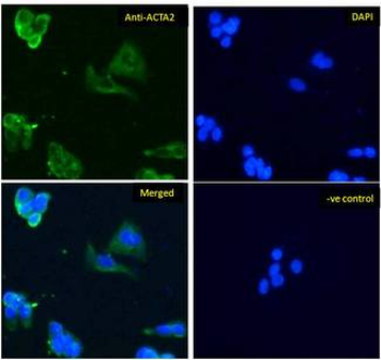 ACTA2/Smooth Muscle Actin Antibody