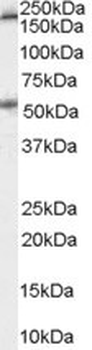 HTR3A/5-HT3A Receptor Antibody