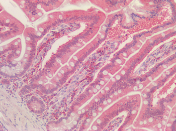 PRDX1/Peroxiredoxin 1 Antibody