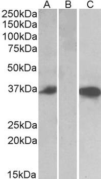 CMA1/Mast Cell Chymase Antibody