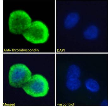 THBS1/Thrombospondin-1 Antibody