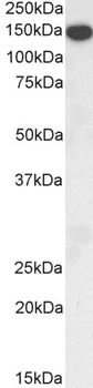 THBS1/Thrombospondin-1 Antibody