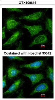 YES1/c-Yes Antibody