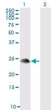 TSC22D3/GILZ Antibody