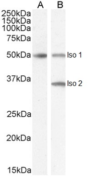 CHGA/Chromogranin A Antibody
