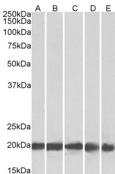 FTL/Ferritin Light Chain Antibody