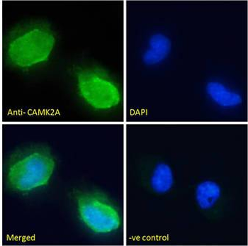CAMK2A/CaMKII Alpha Antibody