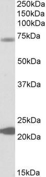 KCNN2 Antibody