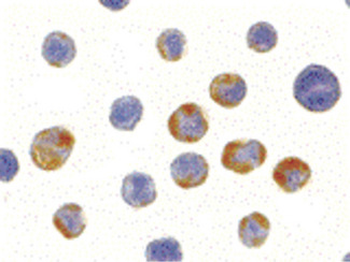 AES/Groucho Antibody