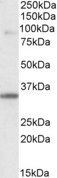 LDB3/ZASP Antibody