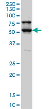 DRAK1/STK17A Antibody