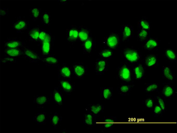SIRT1/Sirtuin 1 Antibody