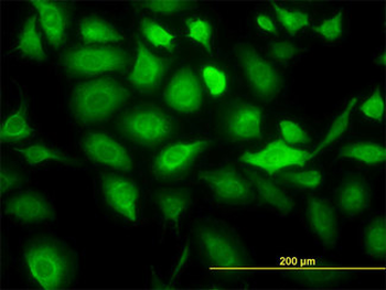 KRT20/CK20/Cytokeratin 20 Antibody