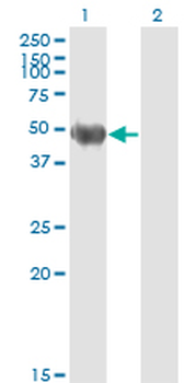 KRT20/CK20/Cytokeratin 20 Antibody