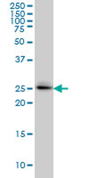 SPSB2 Antibody