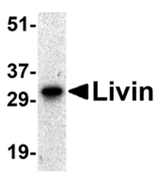 BIRC7/Livin Antibody