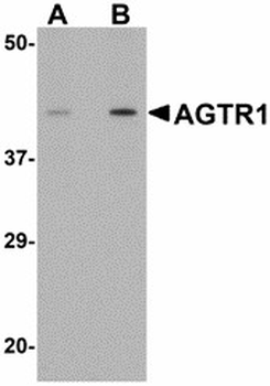 AGTR1/AT1 Receptor Antibody