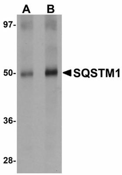 SQSTM1 Antibody
