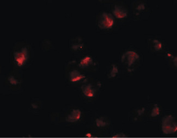 APCL/APC2 Antibody