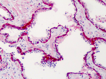 SLFN12 Antibody