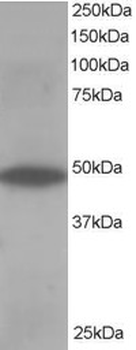 OSBPL1A/ORP1 Antibody