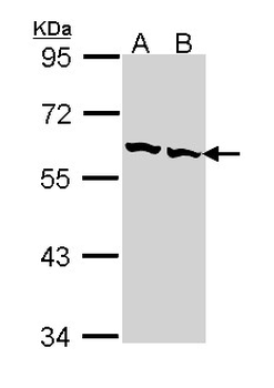 CCT2/CCT Beta Antibody