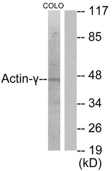 ACTG2 Antibody