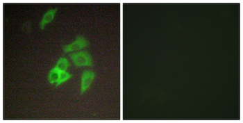 ST14/Matriptase Antibody