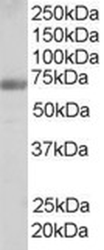 FNBP1/FBP17 Antibody