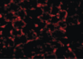 MTCH2 Antibody