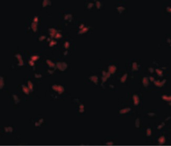 SCARA5 Antibody