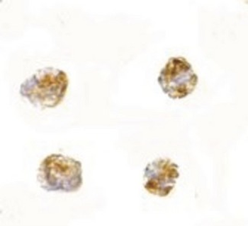 PARL/PSARL Antibody