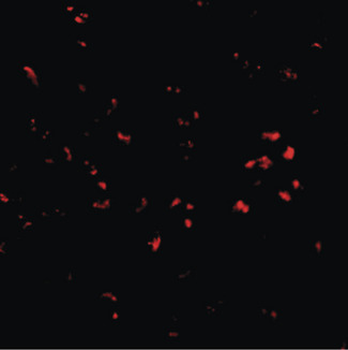 PARL/PSARL Antibody