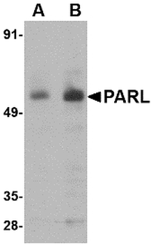 PARL/PSARL Antibody
