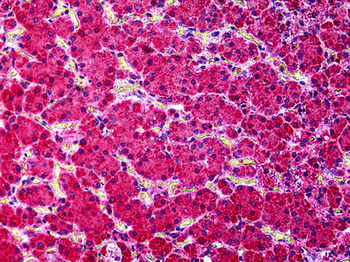 KCNN4/KCa3.1 Antibody