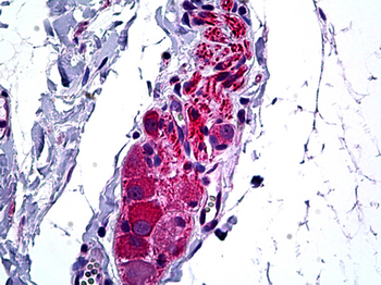 HDAC6 Antibody