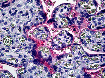 ITGAV/Integrin Alpha V/CD51 Antibody