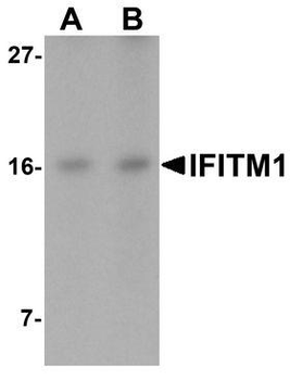 CD225/IFITM1 Antibody