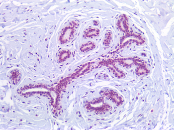 FOXO1/FKHR Antibody