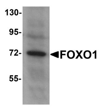 FOXO1/FKHR Antibody