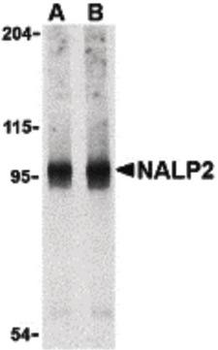 NLRP2/NALP2 Antibody