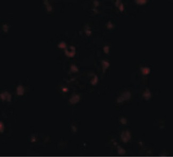 FREM2 Antibody